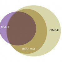 Hlavní obrázek - Současný pohled na možnosti léčby BRAF mutovaného kolorektálního karcinomu