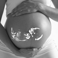 Hlavní obrázek - Vrozený deficit antitrombinu a gravidita – závažný trombofilní stav ohrožující matku i plod