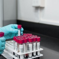 Hlavní obrázek - České i zahraniční novinky v léčbě a výzkumu chronické myeloidní leukemie