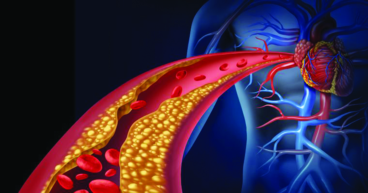 Hlavní obrázek - Méně je lépe než více – zejména v případě cholesterolu