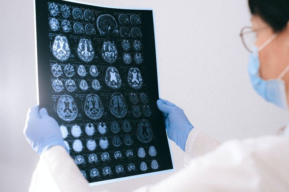 Hlavní obrázek - Encefalopatie při infekci COVID-19 s odezvou na léčbu intravenózními imunoglobuliny