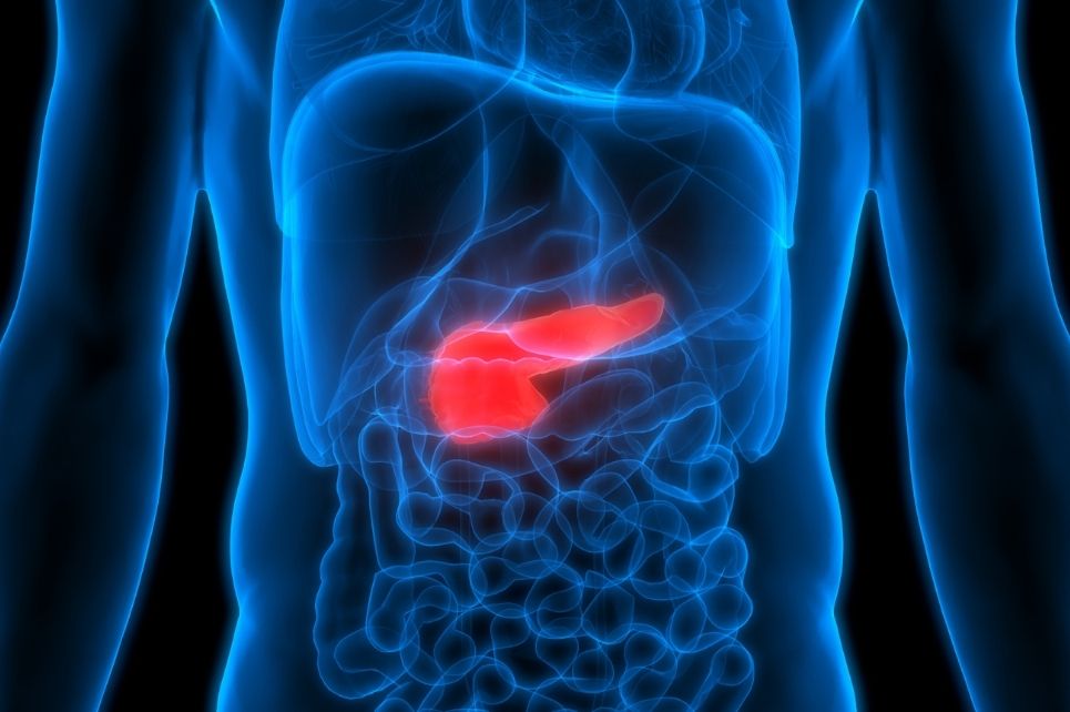 Hlavní obrázek - Screening karcinomu pankreatu: nastal čas vykročit?