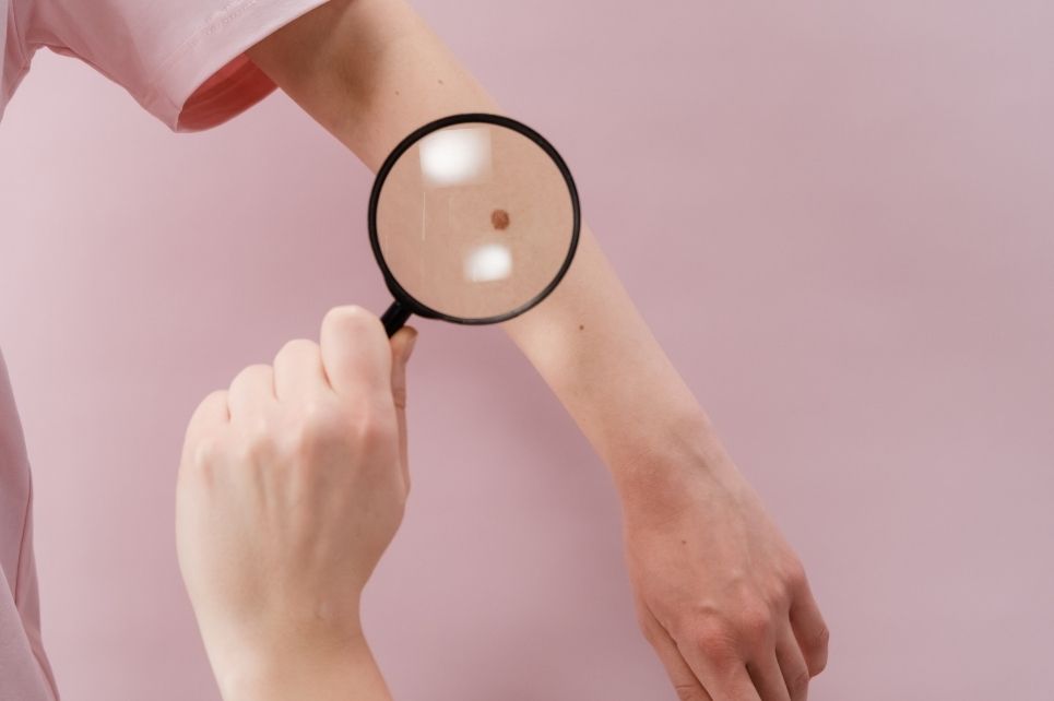 Hlavní obrázek - Selhání adjuvantní léčby maligního melanomu – a co dál?